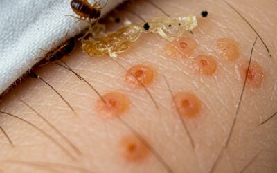 Are You Sure It’s Bed Bugs? 5 Signs That Might Surprise You